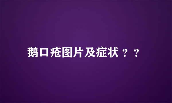 鹅口疮图片及症状 ？？