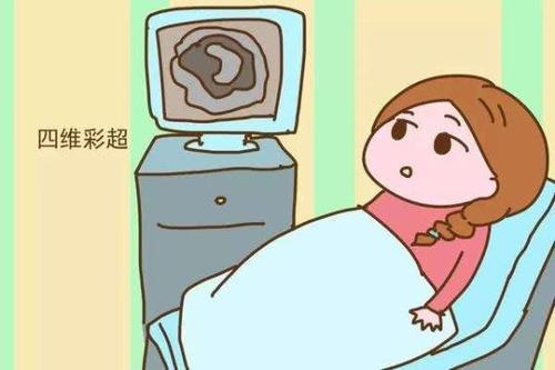 在怀孕期间，做四维彩超的作用是什么？