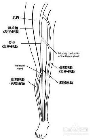 动脉曲张是什么