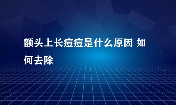 额头上长痘痘是什么原因 如何去除