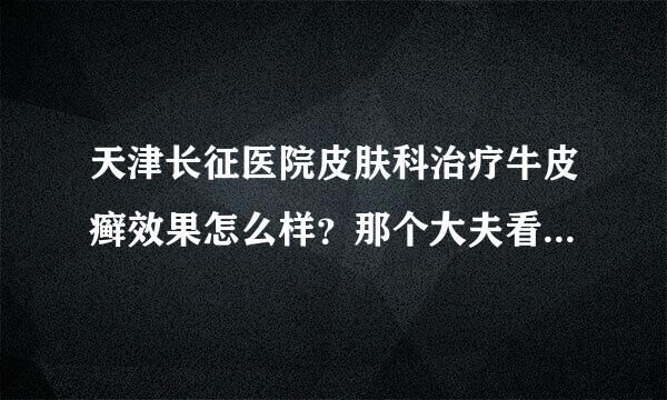 天津长征医院皮肤科治疗牛皮癣效果怎么样？那个大夫看的好一点呢？