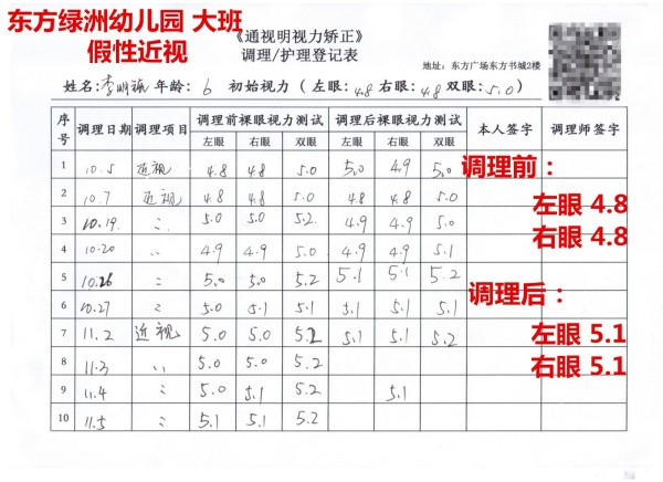 治疗近视眼最好的方法