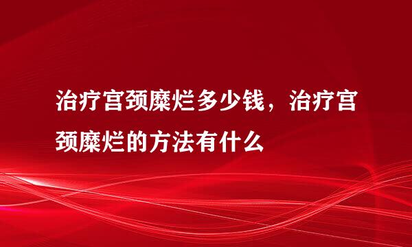 治疗宫颈糜烂多少钱，治疗宫颈糜烂的方法有什么