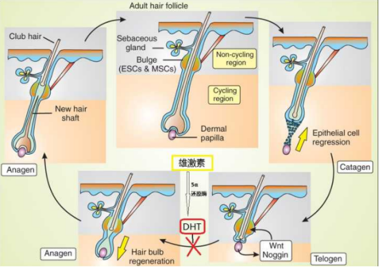 雄激素脱发为什么难治？