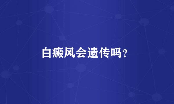 白癜风会遗传吗？