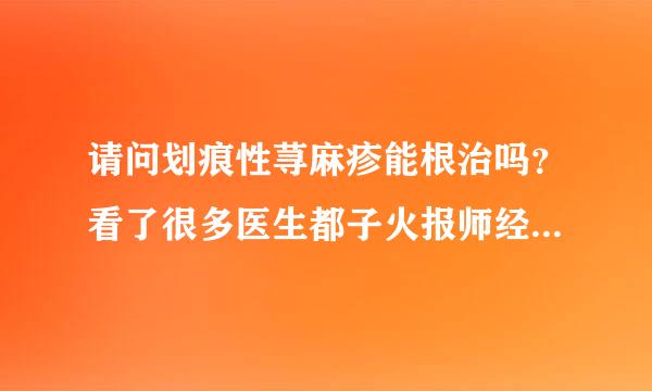 请问划痕性荨麻疹能根治吗？看了很多医生都子火报师经没好？还说要一直吃完，请问怎么才能治好？（女，1天）