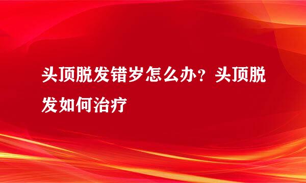 头顶脱发错岁怎么办？头顶脱发如何治疗