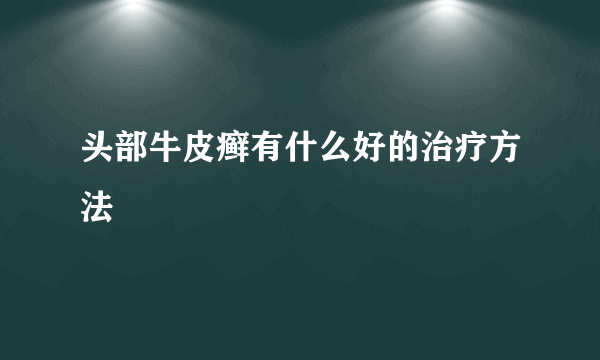 头部牛皮癣有什么好的治疗方法