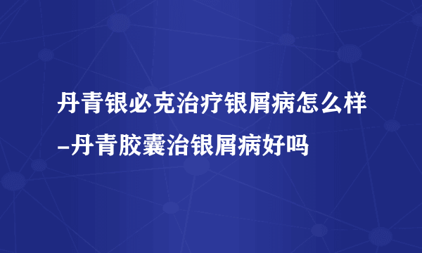 丹青银必克治疗银屑病怎么样-丹青胶囊治银屑病好吗