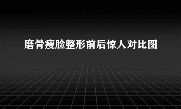 磨骨瘦脸整形前后惊人对比图