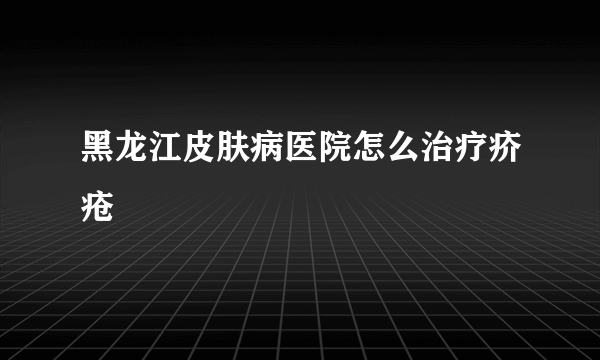 黑龙江皮肤病医院怎么治疗疥疮