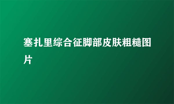 塞扎里综合征脚部皮肤粗糙图片