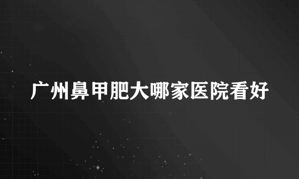 广州鼻甲肥大哪家医院看好