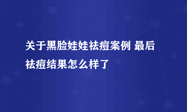 关于黑脸娃娃祛痘案例 最后祛痘结果怎么样了