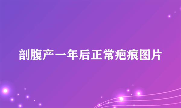 剖腹产一年后正常疤痕图片