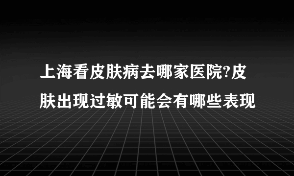 上海看皮肤病去哪家医院?皮肤出现过敏可能会有哪些表现