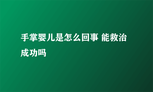 手掌婴儿是怎么回事 能救治成功吗