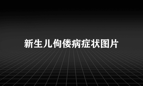 新生儿佝偻病症状图片