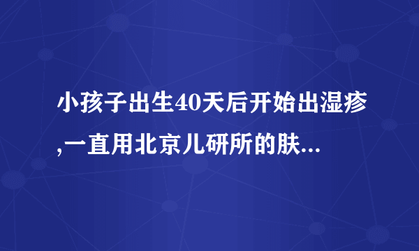 小孩子出生40天后开始出湿疹,一直用北京儿研所的肤乐霜,一抹就好,停药就又痒,一直擦药好吗.到多大就..