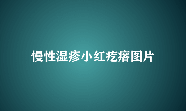 慢性湿疹小红疙瘩图片